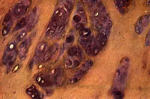 Микроскопическая картина дисхондроплазии