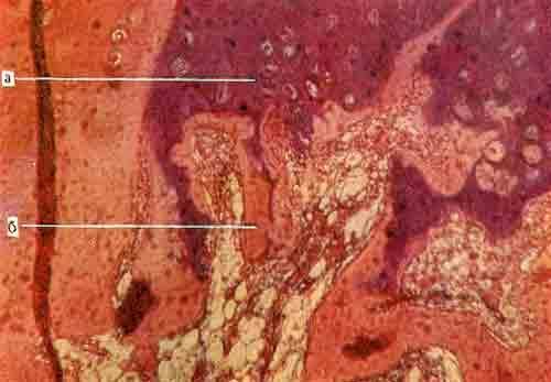 Микроскопическая картина