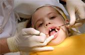 Удаление зубов у взрослых и детей