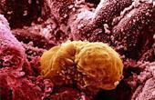 Имплантация эмбриона к стенке матки