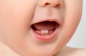 Болезни молочных зубов