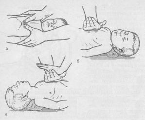 Метод закрытого массажа сердца у детей