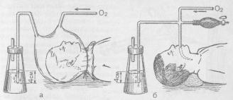 Методы дыхания под постоянным положительным давлением