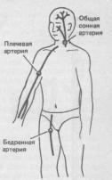 Места прижатия артериальных стволов при кровотечении