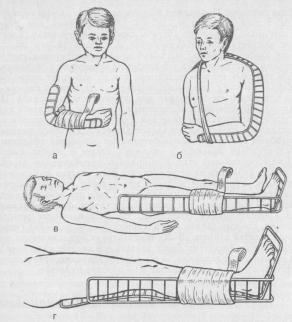 Транспортная иммобилизация при травмах костно-суставного аппарата у детей