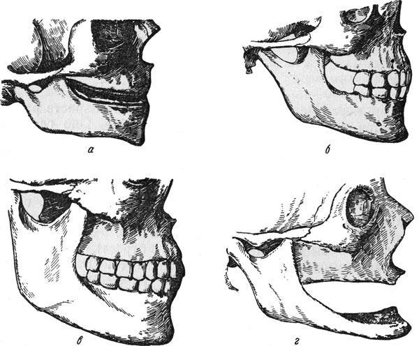 Челюсти (нижняя челюсть)