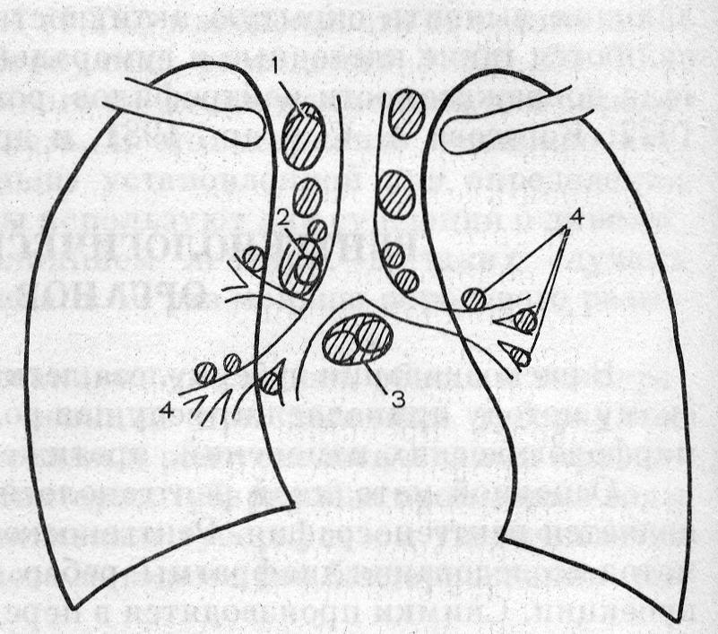 Расположение лимфатических узлов в средостении (по В. А. Сукенникову)