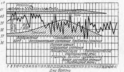 Температурная кривая Али М.