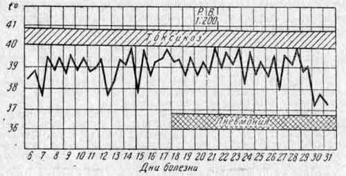 Температурная кривая Риты С., 10 лет