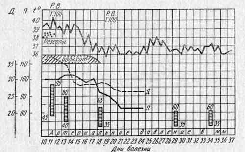 Температурная кривая и динамика артериального давления Вени Т.