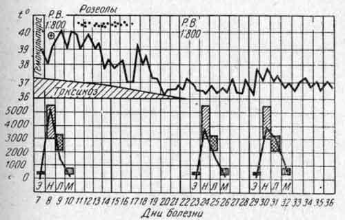 Лейкоцитарный профиль и температурная кривая Вали П., 12 лет