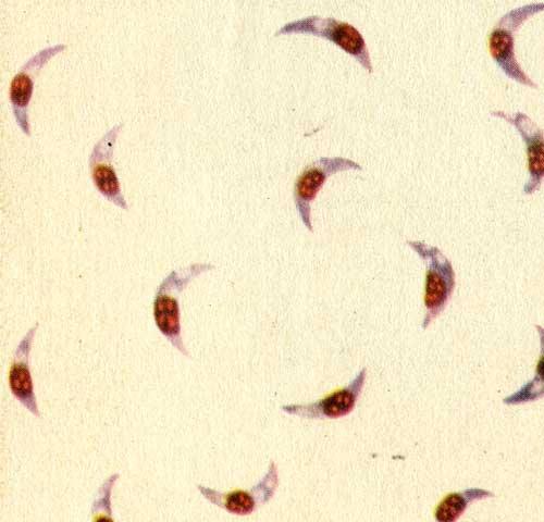 Toxoplasma gondii в перитонеальном экссудате