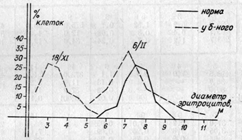 Улучшение кривой Прайс — Джонса в динамике идиопатической аутоиммунной гемолитической анемии у больного Вити Б., 11 лет.