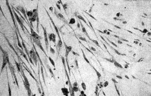 Большое количество клеток, расположенных в виде пласта или веера из контрольной культуры симпатобластомы