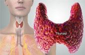 Как предупредить заболевания щитовидной железы