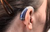 Принцип работы слухового аппарата