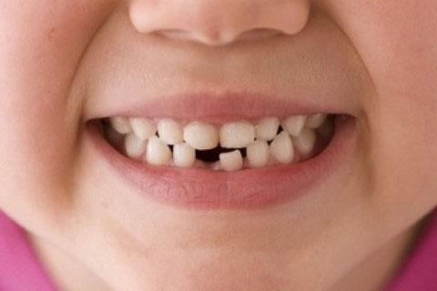 Молочные зубы: лечить или не стоит?