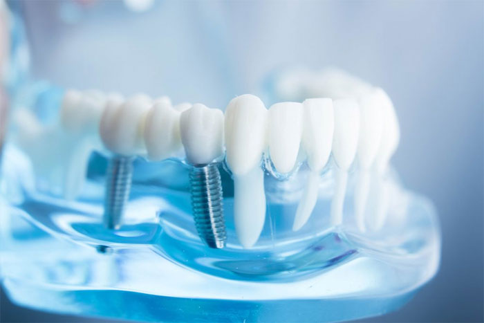Стоматолог на всю жизнь: советы по выбору хорошего специалиста